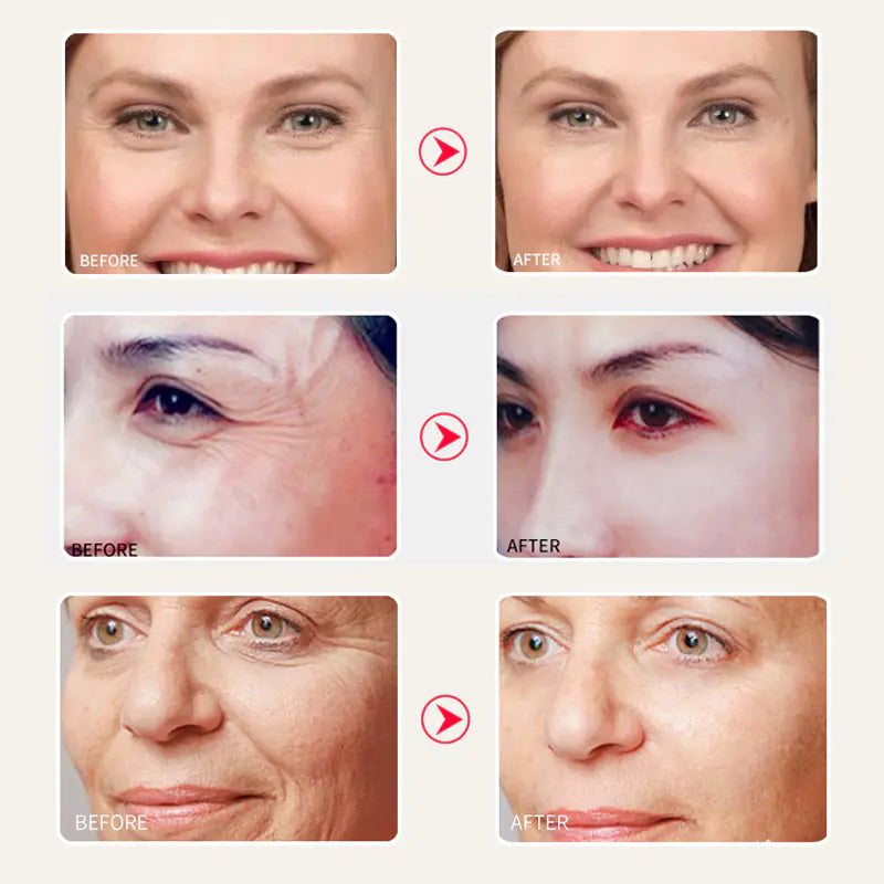 Snail Moisturizing Cream for Repair and Anti-Aging