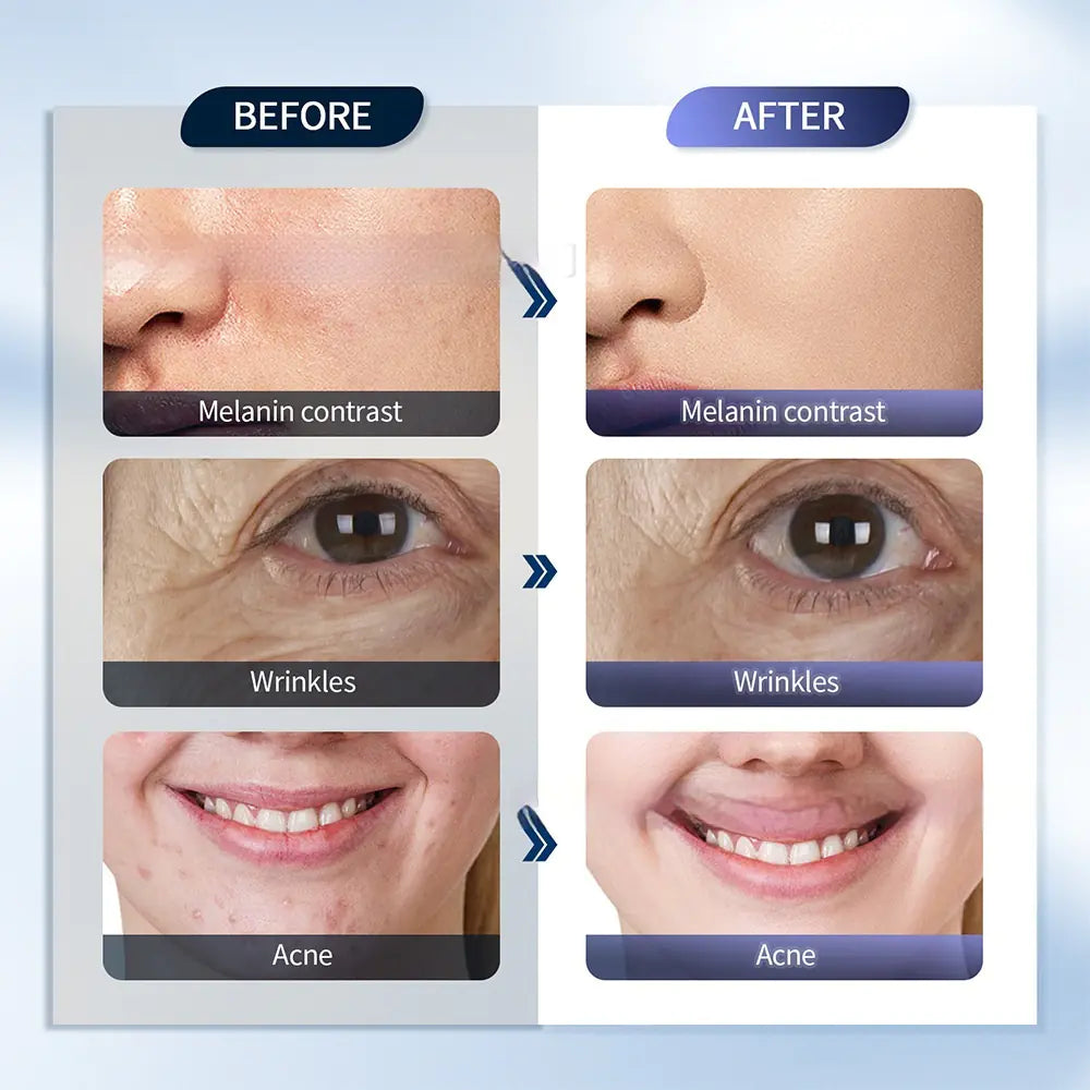 LED Infrared Spray Skin Rejuvenation Machine